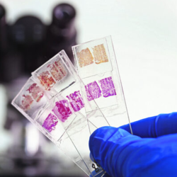 img-post-materiaPrancheta-1